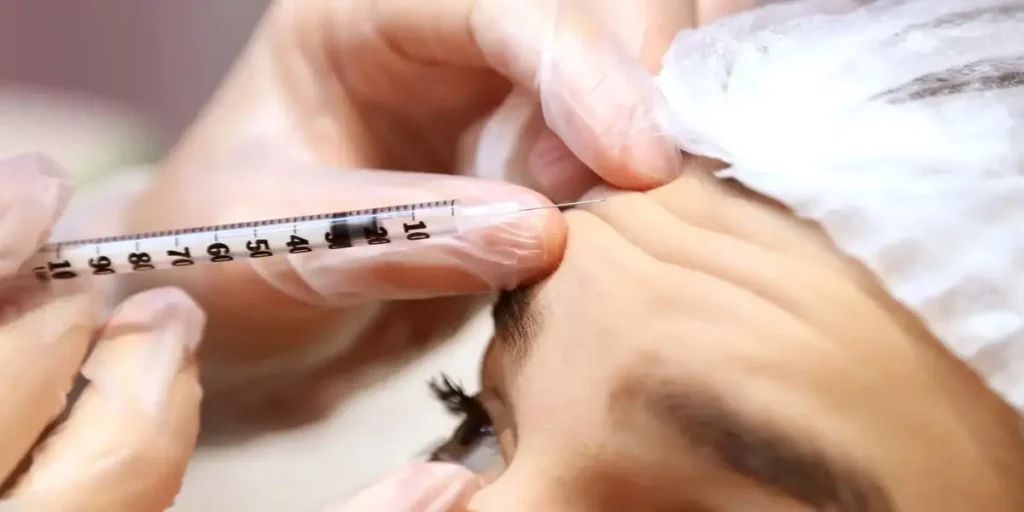 مراقبت های بعد از بوتاکس صورت