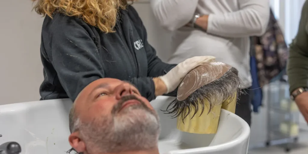 پروتز مو دائم چیست؟