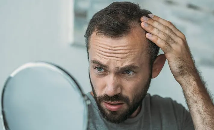 ریزش مو ناشی از مشکلات تیروئید