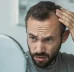 ریزش مو ناشی از مشکلات تیروئید